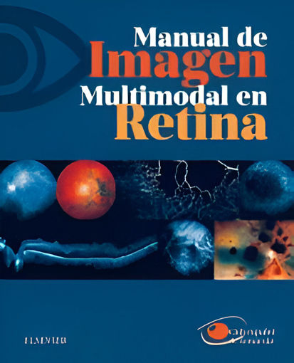 Imagen de MANUAL DE IMAGEN MULTIMODAL EN RETINA