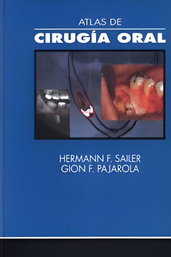 Imagen de Atlas de cirugía oral