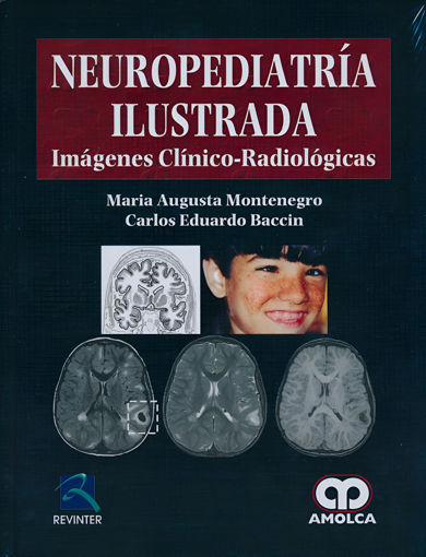 Imagen de Neuropediatría ilustrada Imágenes clínico radiológicas