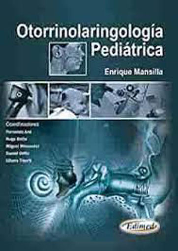 Imagen de PROMO OTORRINOLARINGOLOGIA PEDIATRICA