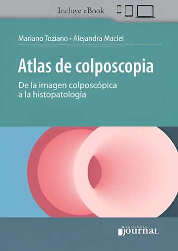 Imagen de Atlas de Colposcopia