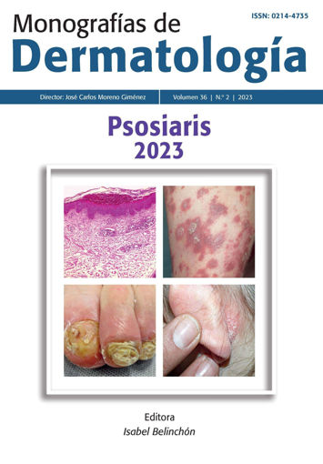 Imagen de Monografías de dermatología Psoriasis 2023