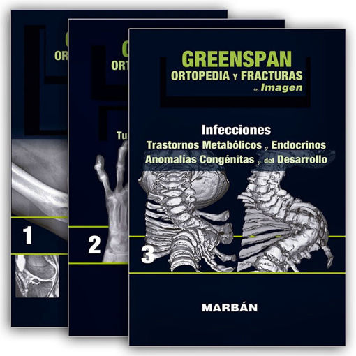 Imagen de Greenspan Ortopedia y fracturas en imagen 3 vols.
