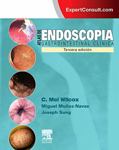 Imagen de Atlas de endoscopia gastrointestinal clínica