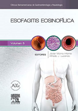 Imagen de Esofagitis Eosinofílica