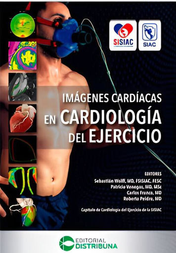 Imagen de Imágenes Cardiacas en Cardiología del Ejercicio