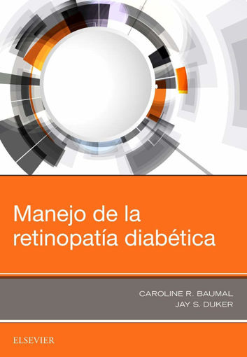 Imagen de Manejo de la retinopatía diabética