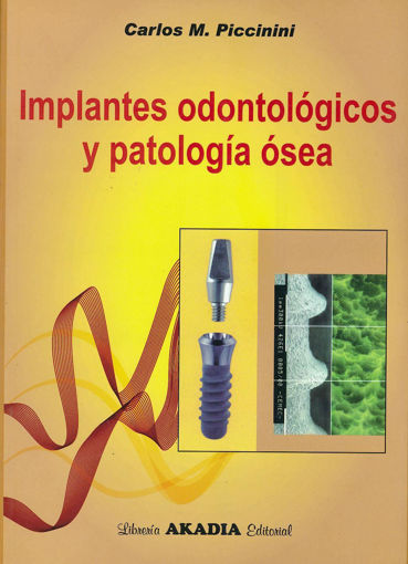 Imagen de Implantes odontológicos y patología ósea