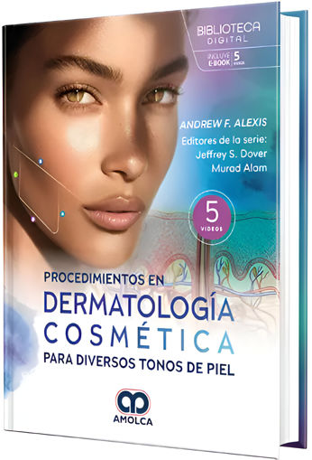 Imagen de Procedimientos en Dermatologia Cosmética para diversos tonos de piel