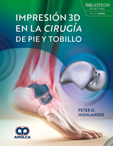 Imagen de Impresion 3D en la cirugia de pie y tobillo
