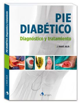 Imagen de Pie diabético Diagnóstico y tratamiento