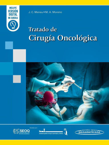 Imagen de Tratado de Cirugia Oncologica