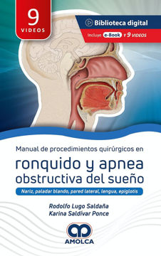 Imagen de Manual de procedimientos quirúrgicos en ronquido y apnea obstructiva del sueño