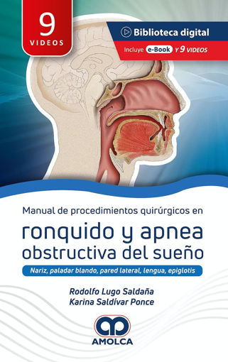 Imagen de Manual de procedimientos quirúrgicos en ronquido y apnea obstructiva del sueño
