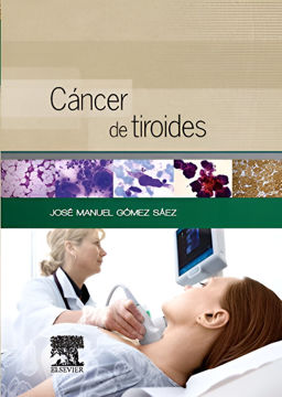 Imagen de Cáncer de tiroides