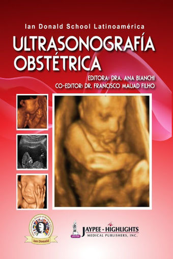 Imagen de Ultrasonografía Obstétrica