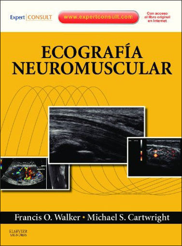 Imagen de Ecografía Neuromuscular