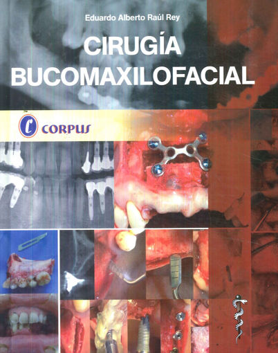 Imagen de Cirugía Bucomaxilofacial