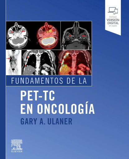 Imagen de Fundamentos de la PET-TC en oncología