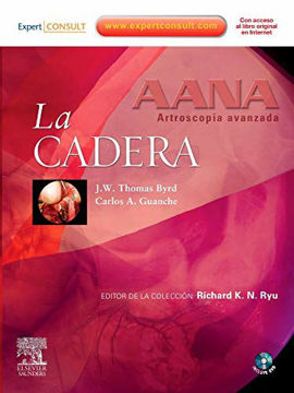 Imagen de AANA Artroscopía avanzada La cadera
