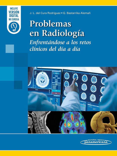 Imagen de Problemas en radiología