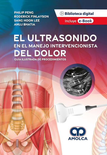 Imagen de El Ultrasonido en el Manejo Intervencionista del Dolor Guía ilustrada de procedimientos