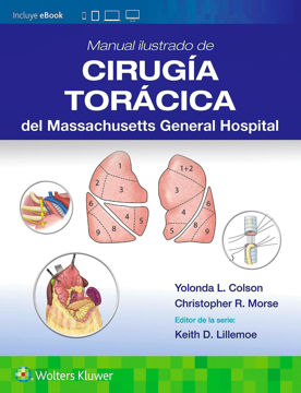 Imagen de Manual ilustrado de Cirugía torácica del Massachusetts General Hospital