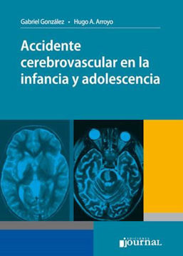 Imagen de ACCIDENTE CEREBROVASCULAR EN LA INFANCIA Y ADOLESCENCIA