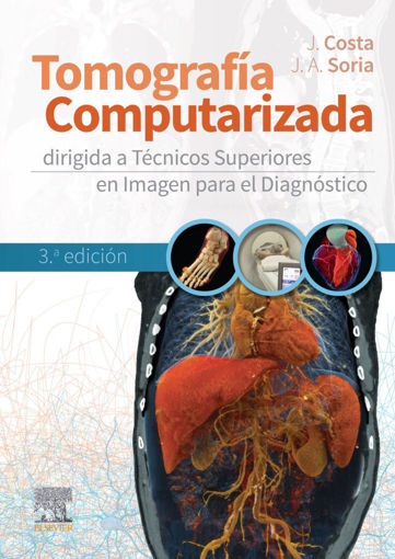 Imagen de Tomografía computarizada dirigida a técnicos superiores en imagen para el diagnóstico 3ed