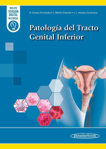 Imagen de Patología del Tracto Genital Inferior